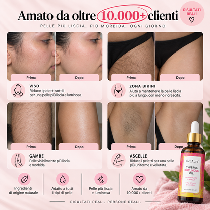 NovaHive™ Olio al Cyperus Rotundus™