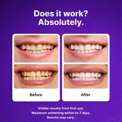Teeth Whitening Strips